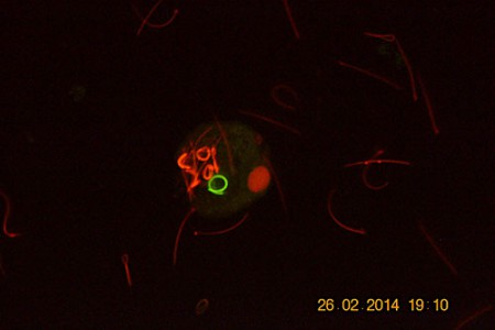 Spermatidi in lombricus - si noti l'elevata capacità differenziante del metodo di colorazione adottato